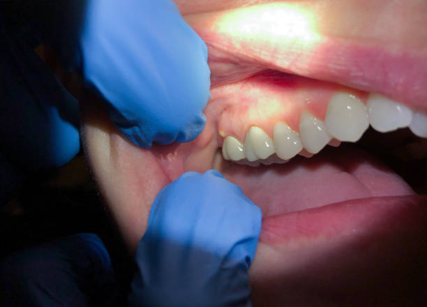 Best After-Hours Dental Trauma Care in Delshire, OH